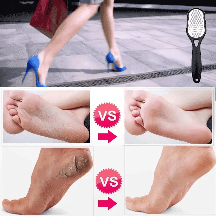 🔥New Year Promotion✨Stainless Steel Exfoliating Foot File
