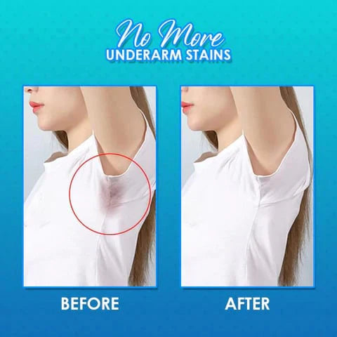 Underarm Sweat Pads (PACK OF 30)